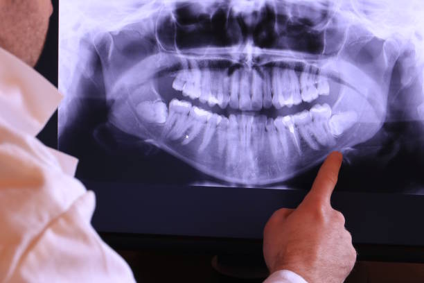 Best Orthodontic Emergency Dentist in Chickasha, OK